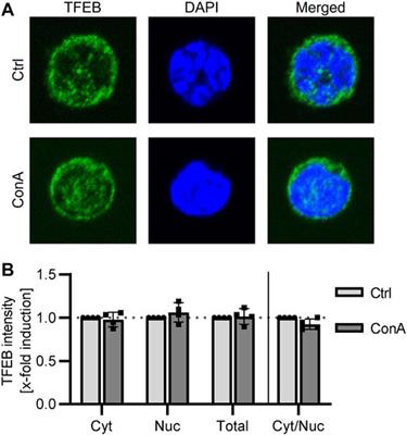 Determination of the autophagic flux in murine and human peripheral blood mononuclear cells